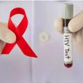 Prueba diagnóstica del VIH/SIDA